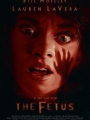 The Fetus 2025